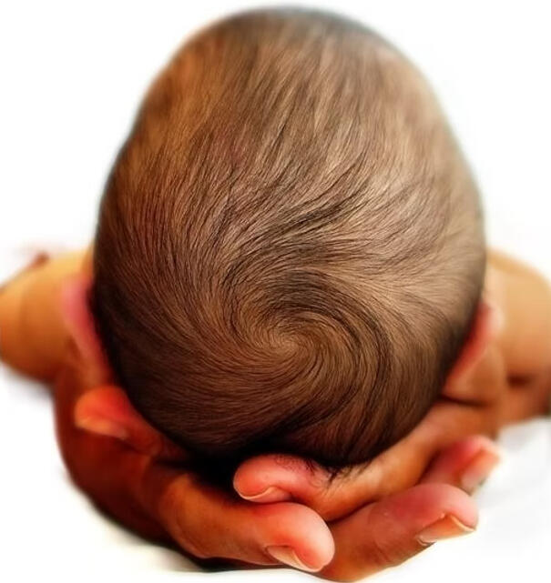 mother babies Baby Plagiocephaly Flat Head North East England Newcastle